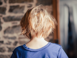 Rzadkie zaburzenia włosów