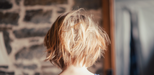 Rzadkie zaburzenia włosów