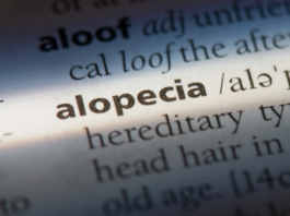 Program lekowy B.173 w ciężkiej postaci łysienia plackowatego – co warto wiedzieć?